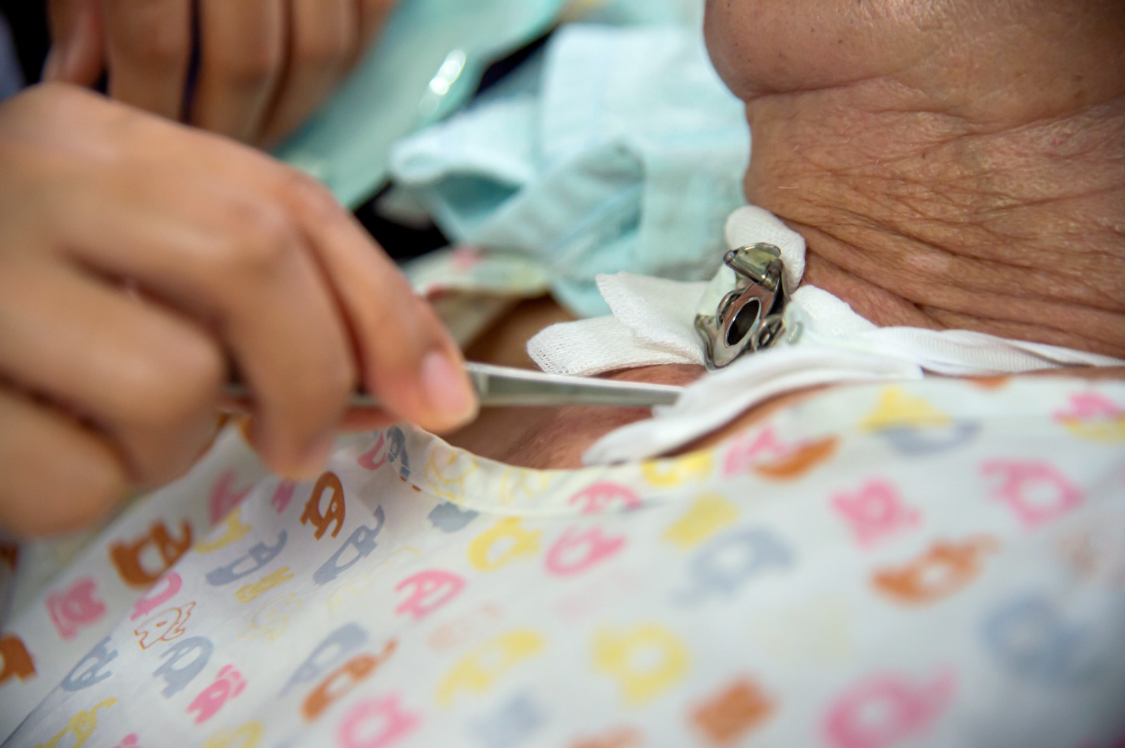 Tracheostomy Care at Home Dubai
